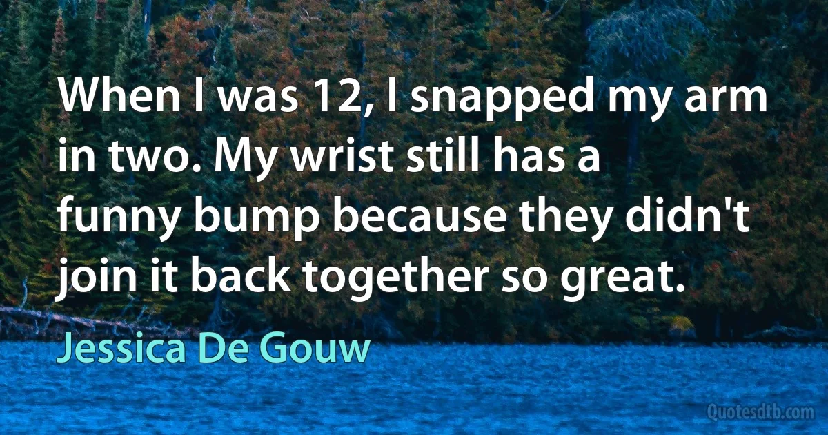 When I was 12, I snapped my arm in two. My wrist still has a funny bump because they didn't join it back together so great. (Jessica De Gouw)